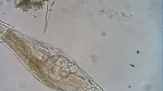 quotPregnantquot Bdelloid Rotifer [upl. by Darci848]