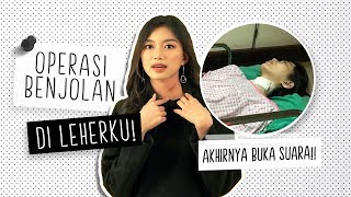 Desy Genoveva Klarifikasi Benjolan di Leher [upl. by Otxilac]