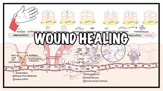 Process of Wound Healing  Wound Healing Process  Nursing Sagar [upl. by Enailil911]