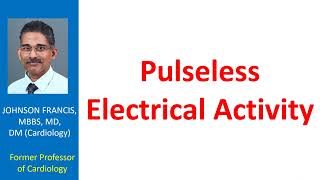 Pulseless Electrical Activity [upl. by Enymzaj]