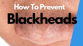 AVOID BLACKHEAD FORMATION with these effective tips [upl. by Enelyar316]