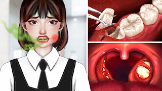 ASMR Dental Cleaning Procedures  Tonsil Stones Removal [upl. by Rolanda]