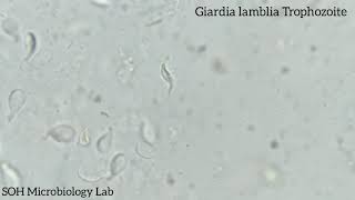 Giardia lamblia Trophozoite in stool [upl. by Atirihs413]