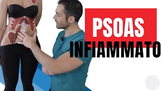 PSOAS INFIAMMATO Ecco cosa fare dolori anca inguine schiena [upl. by Friedberg]