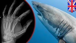 From fish to man New study finds human limbs may have evolved from fish gills  TomoNews [upl. by Tesil]