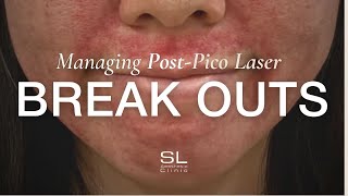 The Ultimate Guide to Managing Post Pico Laser Breakouts [upl. by Notlimah]