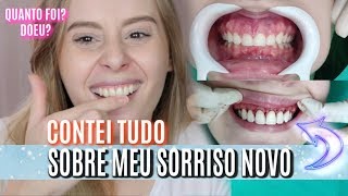 AUMENTEI MEUS DENTES doeu qual valor E MUITO MAIS [upl. by Renaud186]