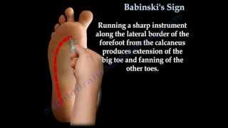 Babinskis Sign  Everything You Need To Know  Dr Nabil Ebraheim [upl. by Boy874]