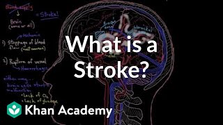 Disorders of Circulatory system various diseases and their properties [upl. by Nazario20]