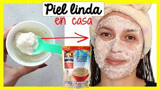 MASCARILLA de AVENA 👩‍🦰 Aclara y ELIMINA el Acné🍚 [upl. by Nollahp]