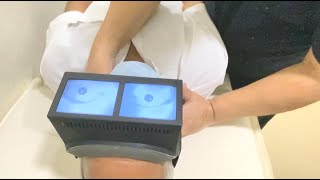 HeadYaw Test Supine Roll Test in Horizontal Semicircular Canal BPPV [upl. by Ivett]