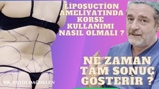 Liposuction Ameliyatında Korse Kullanımı Nasıl Olmalı  Ne Zaman Tam Sonuç Gösterir [upl. by Arraes]