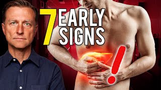 7 Early Signs of Liver Damage [upl. by Snej809]