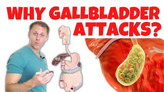 Understanding Gallbladder Attacks [upl. by Barhos]