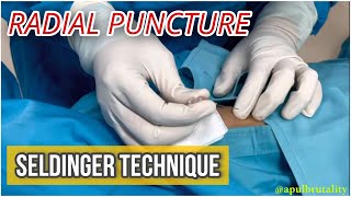 Radial puncture with Seldinger technique  tutorial  coronary angiography [upl. by Muller]