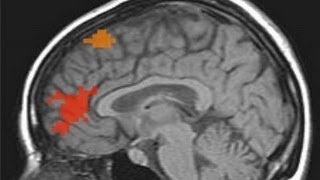 Anterior cingulate cortex [upl. by Olrac]