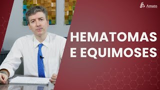 Roxos nas pernas Hematomas Equimoses e Petéquias [upl. by Bluh]