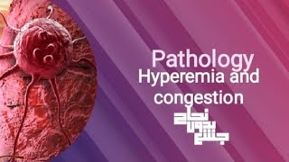 Hyperemia and congestionpathoL14 part 1 [upl. by Sollie]