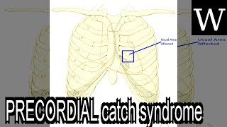 PRECORDIAL catch syndrome  WikiVidi Documentary [upl. by Paddy]