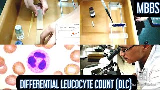 Differential Leucocyte Count DLC Practical  MUHS  mbbs physiology hematology [upl. by Joris]