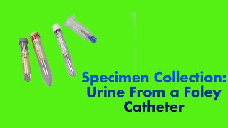 Specimen Collection Urine from a Foley Catheter [upl. by Ivetts361]