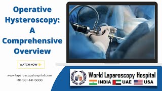 Operative Hysteroscopy A Comprehensive Overview [upl. by Ayiram]