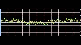 Melanosis  Rife Frequencies [upl. by Budd]