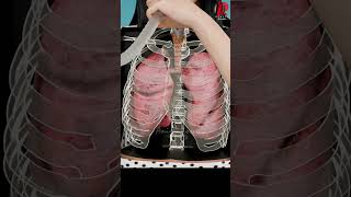 The Truth About Incentive Spirometry Doctor Explained [upl. by Sang247]