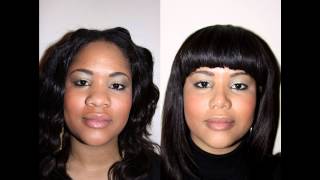 African American Female Rhinoplasty NYC Before amp After Dr Sam Rizk [upl. by Berna]