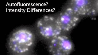 Fluorescence In Situ Hybridization FISH Review [upl. by Mcclenaghan]