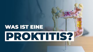 Was ist eine PROKTITIS Dr Eduard Karsten klärt auf [upl. by Delahk]