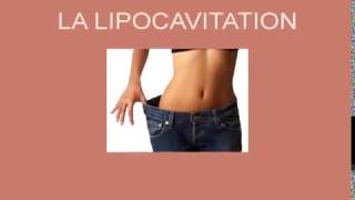 Liposuccion sans chirurgie lipocavitation cellulite et remodelage corporel  voyez les résultats [upl. by Marty]