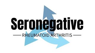 Seronegative Rheumatoid Arthritis rheumatology rheumatoid seronegative [upl. by Mercer687]