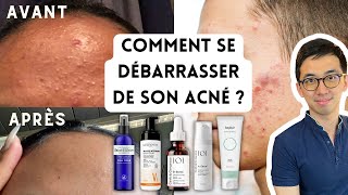 PEAU SANS ACNÉ  BOUTONS BLANCS OU ROUGES MICROKYSTES PLAQUES DE BOUTONS PAPULES PUSTULES [upl. by Canotas347]