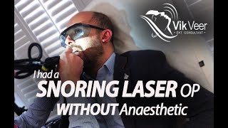 NightLase  Somnilase  Snoring Laser WITHOUT anaesthetic [upl. by Hampton292]