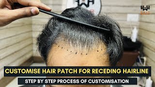 Hairline Receding solution  Customise Frontline hair patch  Hair wig house [upl. by Ermin746]