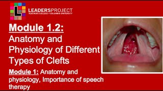 Development Of Palate  Embryology  Easy Explaination  Cleft Palate  Defective Development [upl. by Bolger]