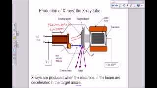 A level Medical Physics  X rays the X ray tube [upl. by Auqeenahs]