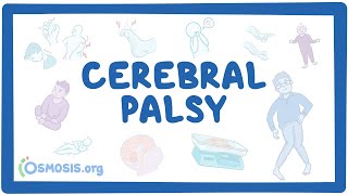 Cerebral palsy CP  causes symptoms diagnosis treatment pathology [upl. by Yecrad]