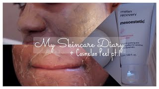 My Skincare Diary Ep 1  Cosmelan Peel pt 1 [upl. by Dulci]