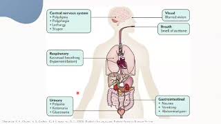 Cetoacidosis diabética  Endocrinología Pediátrica [upl. by Careaga398]