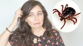 Tick season is upon us Heres everything you need to know [upl. by Dami]