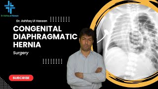 Congenital Diaphragmatic Hernia High Yield Topic Pediatrics [upl. by Briggs]