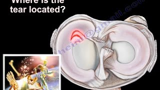 Anatomy of the knee joint [upl. by Roane888]