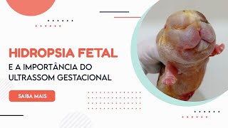 HIDROPSIA FETAL  Ultrassonografia Gestacional Veterinária [upl. by Anwadal]