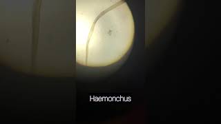 Haemonchus spp [upl. by Hauger]