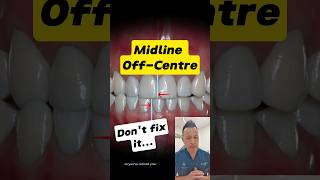 Why Your OffCenter Midline Is No Big Deal dentallan dentist shorts [upl. by Judie]