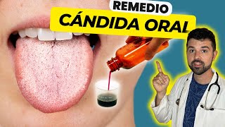 CANDIDIASIS Una Infección de HONGOS en la BOCA y LENGUA [upl. by Ecirtak]