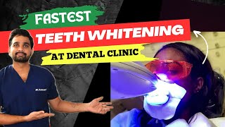 Teeth whitening process  Bleaching in dental clinic [upl. by Tenay]