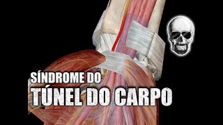 SÍNDROME do TÚNEL do CARPO e o NERVO MEDIANO  Anatomia Humana [upl. by Sumaes]